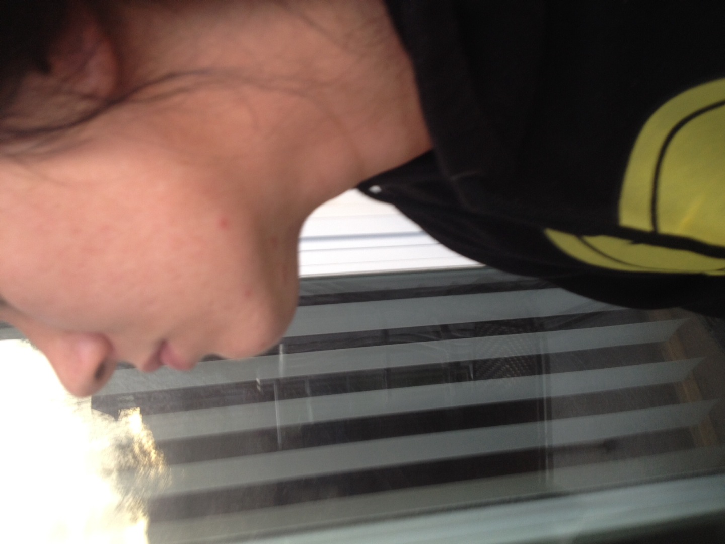 Broken jaw help Jaw Conditions Symptom Our Health